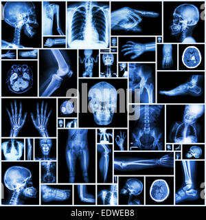 Kollektion Röntgen mehrere Teile des menschlichen