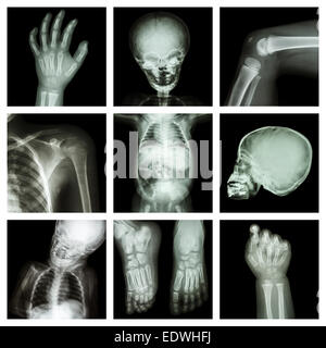 Kollektion x-ray Teil der Körper des Kindes Stockfoto