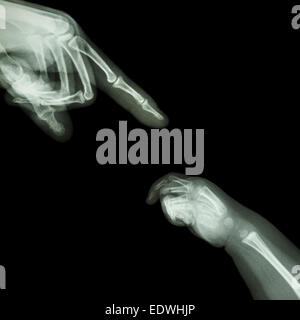 X-ray Erwachsenen Hand Punkt Finger auf Oberseite und Babys Hand an Unterseite Stockfoto