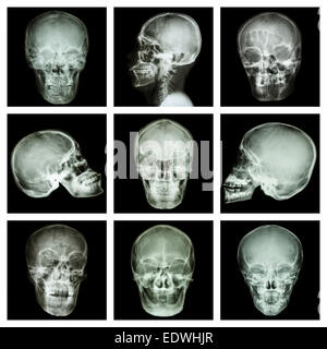 Sammlung von asiatischen Schädel Stockfoto