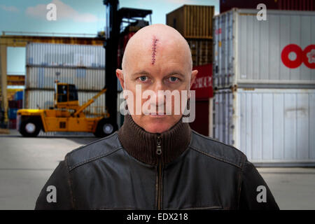 Mann mit Stichen in eine schwere Kopfverletzung Stockfoto