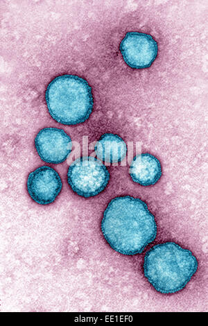 RESPIRATORY SYNCYTIAL VIRUS Stockfoto