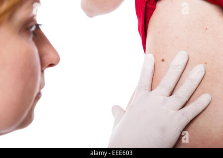 Ärztin untersuchen Haut mit Maulwurf Stockfoto