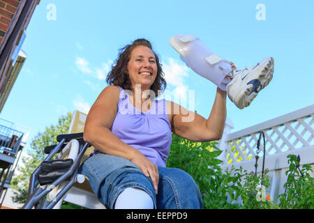 Frau mit Spina Bifida Angeberei neue Beinschiene Stockfoto