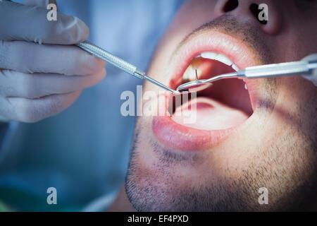 Der Mann mit den Zähnen untersucht hautnah Stockfoto