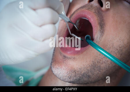 Der Mann mit den Zähnen untersucht hautnah Stockfoto