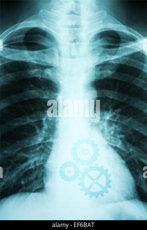 X-ray Foto von Menschen zeigen Herz mit Zahnräder arbeiten Stockfoto
