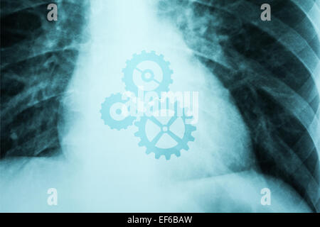 X-ray Foto von Menschen zeigen Herz mit Zahnräder arbeiten Stockfoto