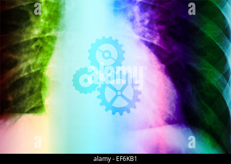 X-ray Foto von Menschen zeigen Herz mit Zahnräder arbeiten Stockfoto