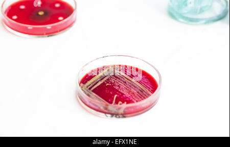 Zwei Petrischalen mit Bakterien wachsen in Ihnen Stockfoto