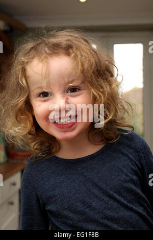 Ein schönes junges Mädchen in Three-Year-Old mit Windpocken, abgebildet in ihrem Haus in West Sussex, UK. Stockfoto