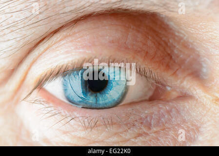 Makro von einer harten Kontaktlinse auf Frau blaues Auge Stockfoto