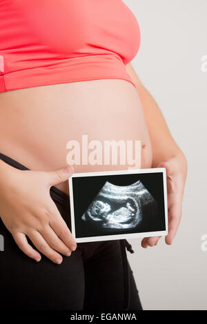 Frau mit einer Ultraschalluntersuchung ihres ungeborenen Babys Stockfoto