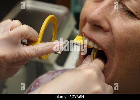 Frau beim Zahnarzt mit Röntgen-Modell veröffentlicht Stockfoto