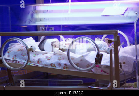 Neugeborenen vorzeitige im Inkubator unter blauem UV-Licht Stockfoto
