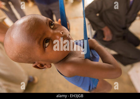 KOMOBANGAU, Provinz TILLABERI, NIGER, 15. Mai 2012: ein Kind mit schweren Malnutition wird in der lokalen Gesundheitszentrum wöchentliche Klinik behandelt. Stockfoto