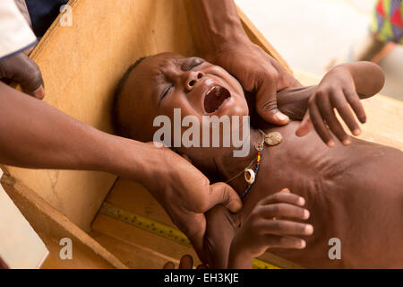 KOMOBANGAU, Provinz TILLABERI, NIGER, 15. Mai 2012: ein Kind mit schweren Malnutition wird in der lokalen Gesundheitszentrum wöchentliche Klinik behandelt. Stockfoto