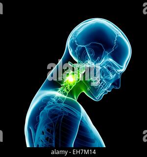 Menschlichen Halswirbelknochen, Abbildung Stockfoto