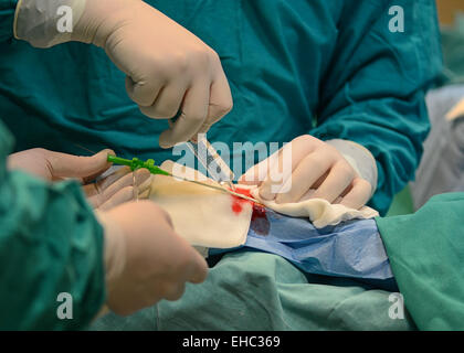 Katheterablationsverfahren im Universitätsklinikum Schwester von Mercy in Zagreb, Kroatien Stockfoto