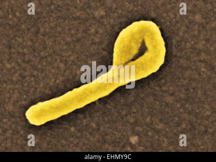 Farbige scanning Electron Schliffbild (SEM) von einer Ebola-Virus-Partikel. Stockfoto
