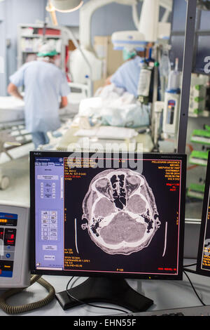 Thrombektomie durchgeführt unter zerebrale Angiographie bei einem Patienten mit Symptomen eines Schlaganfalls, Neuro-vaskuläre Einheit (UNV) CHU Bordeaux. Stockfoto