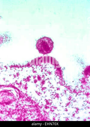 Detail von einem menschlichen Immunodeficiencyvirus (HIV) Viruspartikel oder Virion, Transmission Electron Schliffbild (TEM). Stockfoto