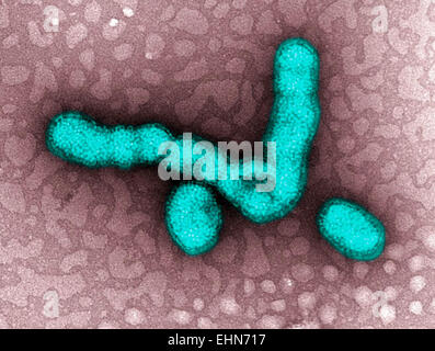 Transmission Electron Schliffbild (TEM) zeigt die Anzahl der H1N1-Influenza-Virus-Partikel. Stockfoto