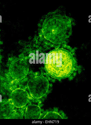 Farbige Transmission Electron Schliffbild (TEM) eines Partikels MERS Coronavirus, dieses Virus (ursprünglich neuartigen Corona-Virus 2012) wurde zum Nahen Osten respiratorisches Syndrom (MERS) Coronavirus. Stockfoto