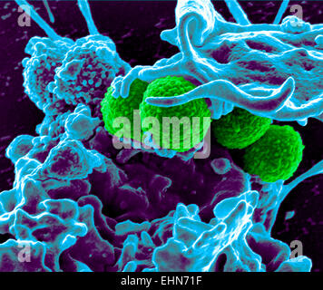 Farbige scanning Electron Schliffbild (SEM) von Methicillin-resistenten Staphylococcus Aureus (MRSA) Bakterien. Stockfoto