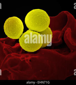 Farbige scanning Electron Schliffbild (SEM) von Methicillin-resistenten Staphylococcus Aureus (MRSA) Bakterien. Stockfoto