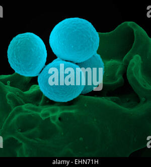 Farbige scanning Electron Schliffbild (SEM) von Methicillin-resistenten Staphylococcus Aureus (MRSA) Bakterien. Stockfoto