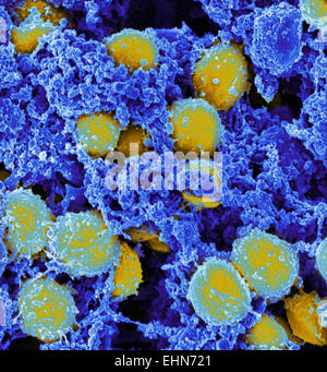 Farbige scanning Electron Schliffbild (SEM) von Methicillin-resistenten Staphylococcus Aureus (MRSA) Bakterien. Stockfoto