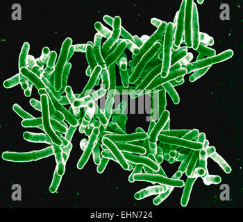 Mycobacterium-Tuberkulose-Bakterien, diese grampositiven stabförmigen Bakterien Ursache der Krankheit Tuberkulose, eingefärbte scanning Electron Schliffbild (SEM). Stockfoto