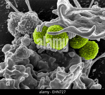 Farbige scanning Electron Schliffbild (SEM) von Methicillin-resistenten Staphylococcus Aureus (MRSA) Bakterien. Stockfoto