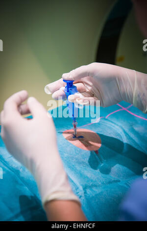 CT-Scan-gestützte Biopsie, Saint-Louis Krankenhaus, Paris, Frankreich. Stockfoto