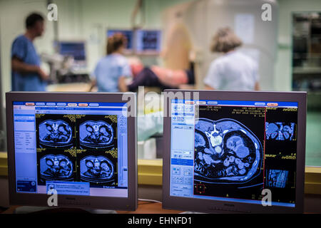 CT-Scan-gestützte Biopsie, Saint-Louis Krankenhaus, Paris, Frankreich. Stockfoto