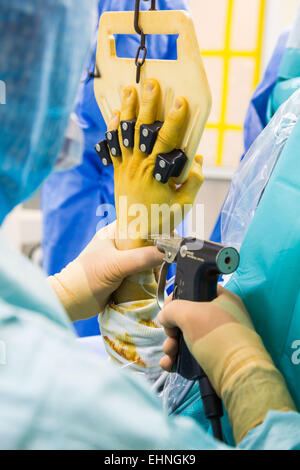 PIN auf ein gebrochenes Handgelenk-Arthroskopie, Jouvenet Klinik, Paris, Frankreich. Stockfoto