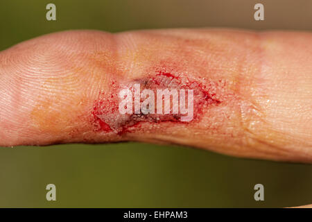 Fleischwunde mit Blut auf männliche finger Stockfoto