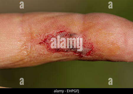 Fleischwunde mit Blut auf männliche finger Stockfoto