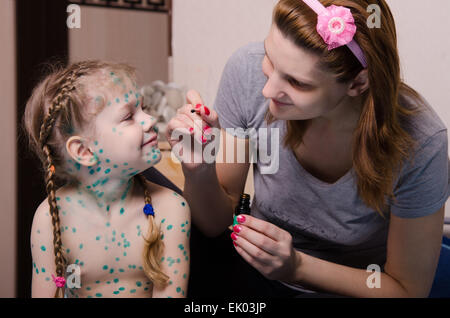 Mutter vermisst Zelenkoj Wunden auf den ersten Blick ein Kind leidet an Windpocken Stockfoto