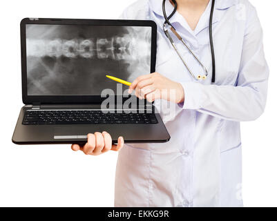 Krankenschwester Punkte auf Computer Laptop mit Röntgenbild der menschlichen Wirbelsäule auf Bildschirm isoliert auf weißem Hintergrund Stockfoto