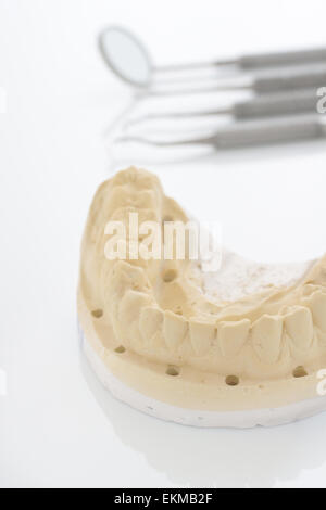 Kieferorthopädische oder oberkiefermodelles in der Zahnheilkunde flachen selektiven Fokus auf der Vorderseite des cast verwendet Stockfoto