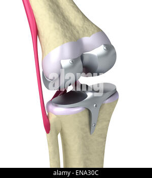 Knie und Titan Scharniergelenk. Isoliert auf weiss Stockfoto