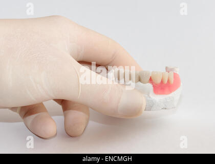 Die Hand hält in einem Schutzhandschuh und zeigt künstliche Dentalny Designs. Stockfoto