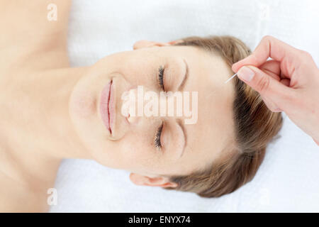 Akupunkturnadeln auf eine entspannte Frauenkopf Stockfoto