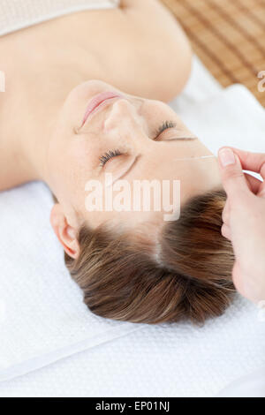 Akupunkturnadeln am Kopf einer Cauasian Frau Stockfoto