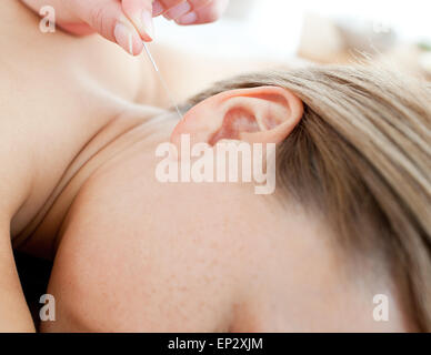 Akupunkturnadeln auf eine junge Frau Ohr Stockfoto