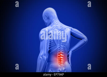 Menschlichen markierte rote Schmerzen im unteren Rücken reiben Digital Blau Stockfoto