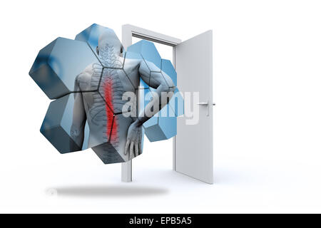 Zusammengesetztes Bild Rückenverletzung Diagramm auf abstrakte Bildschirm Stockfoto