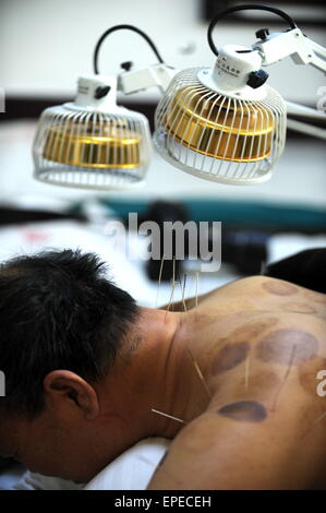 (150518)--Peking, 18. Mai 2015 (Xinhua)--Datei Foto am 14. März 2011 zeigt ein Patient Akupunktur-Behandlung in einem Krankenhaus in Liangzhou, Nordwesten Chinas Provinz Gansu. Akupunktur und Moxibustion sind Formen der traditionellen chinesischen Medizin in China weit verbreitet und auch in den Regionen Süd-Ost-Asien, Europa und Amerika gefunden. Sie gehören zu den am häufigsten praktizierten chinesischen Therapien im Land und gewinnt immer mehr Popularität im Westen. Die Theorien von Akupunktur und Moxibustion halten, dass der menschliche Körper als ein kleines Universum, die durch Kanäle verbunden fungiert Stockfoto